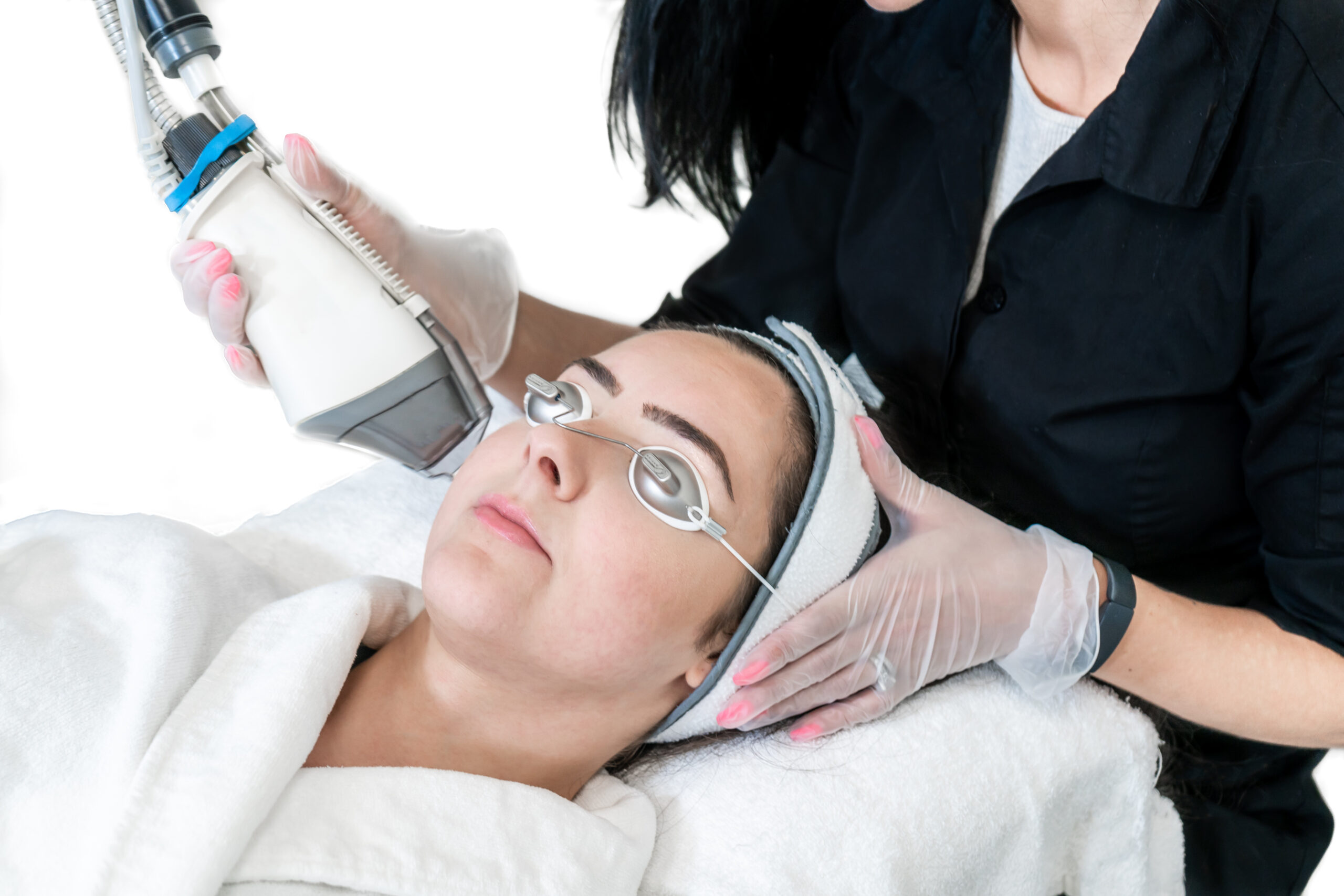 laser hair removal | fractional arm procedure
